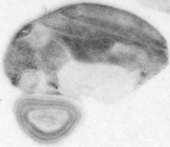 BDNF in situ-hybridization of the male zebra finch forebrain with a radioactive probe for the protein coding exon