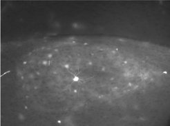 AreaX-projection neurons of the HVC before testosterone treatment