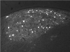 AreaX-projection neurons of the HVC after testosterone treatment