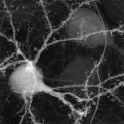 Spiny dendrites of an AreaX-projection HVC neuron