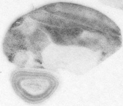 In situ Hybridisierung mit einer radioaktiven Sonde für das Protein codierende Exon des BDNF Gens.