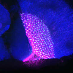 Durch die neue Technik leuchten in Nervenzellen, die Bewegungen verarbeiten (magenta) bestimmte Rezeptorproteine grün auf.