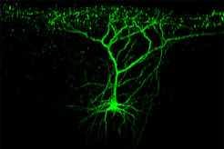 Store-room for future learning. Nerve cells retain many of their newly created connections and if necessary, inactivate only transmission of the information. This makes relearning easier.