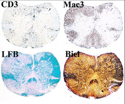 Multiple sclerosis is a very complex disease of the nervous system. Thanks to the development of the new animal model, significantly improved insights into its emergence and progress are now possible.