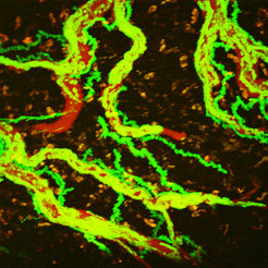 The picture shows the movement of crawling T-cells (green) inside blood vessels (red) over a period of about 20 minutes. It clearly shows that some T-cells leave the blood vessels - the long exposure lets them leave a green trail as the cells make their way through the brain tissue.