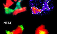 Going live – immune cell activation in multiple sclerosis