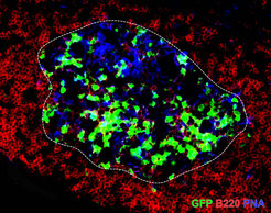 Autoaggressive B-cells (green) in a lymph node close to the brain. The activation of the B-cells takes place in the germinal centres (blue) of the lymph node. The activated cells produce antibodies against the myelin layer in the brain, thus contributing to the occurrence of inflammatory reactions.