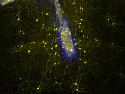 Neuronal transplants (blue) connect with host neurons (yellow) in the adult mouse brain in a highly specific manner, rebuilding neural networks lost upon injury.