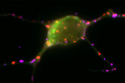 In the amygdala kernel, experiences are linked with emotions. How a small molecule influences this process has now been revealed.