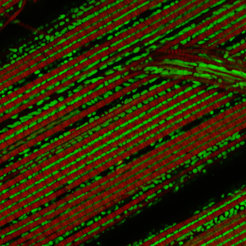 The PINK1 gene plays a role in Parkinson’s disease. If the gene is switched off in the fly, the mitochondria (green) are damaged and the animal’s muscle fibres (red) disintegrate. The activation of the Ret receptor, which binds the growth factor GNDF in humans, counteracts this degeneration.