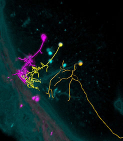 Researchers can activate individual neurons in the zebrafish brain with light (magenta) and observe which neighboring cells are connected to the neuron in the same circuit (yellow).