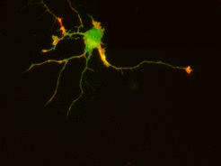 Countless Eph receptors (green) can be found on the surface of this neuron. When they are artificially induced to form groups, the nerve process, or axon (red tip), withdraws.