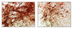 In Parkinson's disease, nerve cells die in a structure of the midbrain, the substantia nigra. Compared to a healthy mouse brain (left), the diseased mouse brain (right) shows considerable loss of nerve cells. Max Planck Scientists and their colleagues have now been able to show that such pronounced cell death is triggered only when three conditions are met.