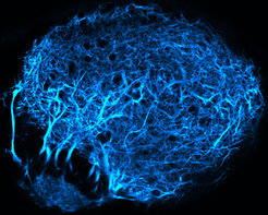 Thezebrafish tectum recognizes an approaching object as a threat. This brain area is innervated by axons from the eye (stained blue).