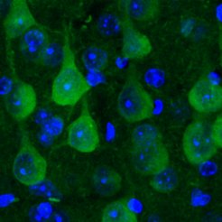 In gesunden Nervenzellen der Maus verteilt sich der Proteostase-Sensor (in Grün) gleichmäßig.