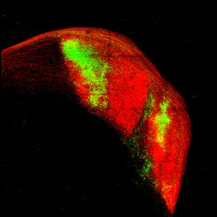 Informationen beider Augen erreichen den visuellen Thalamus in abgegrenzten Bereichen. Nervenfasern dargestellt in Grün kommen vom Auge, welches sich auf der gleichen Körperseite wie der abgebildete Thalamus befindet, Nervenfasern in Rot vom gegenüberliegenden Auge.