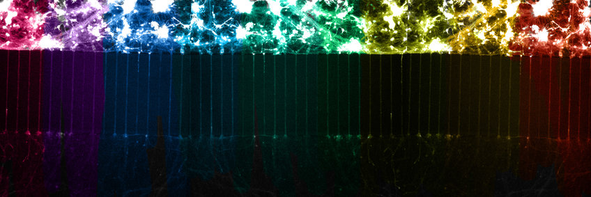 Neurons grown in microfluidic chambers can be used to treat axons and cell bodies separately