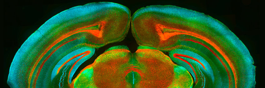 Department Synapses - Circuits - Plasticity