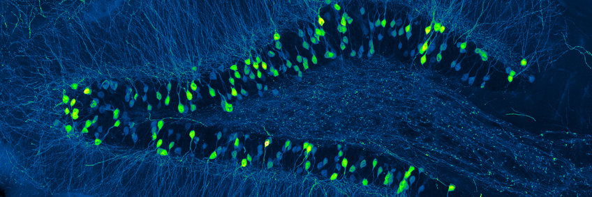 Fluoreszenzmikroskopiebilb, auf dem einzelne Zellen als hellgrüne Punkte und blaue Linien sichtbar sind.
