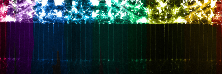 Neurometabolismus Neurons grown in microfluidic chambers can be used to treat axons and cell bodies separately.