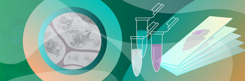 EM-Histo-Labor Gezeichnetes Bild von Eppendorf-Gefäßen und Objektträgern. Daneben ein Ausschnitt eines Mikroskopie-Bildes.